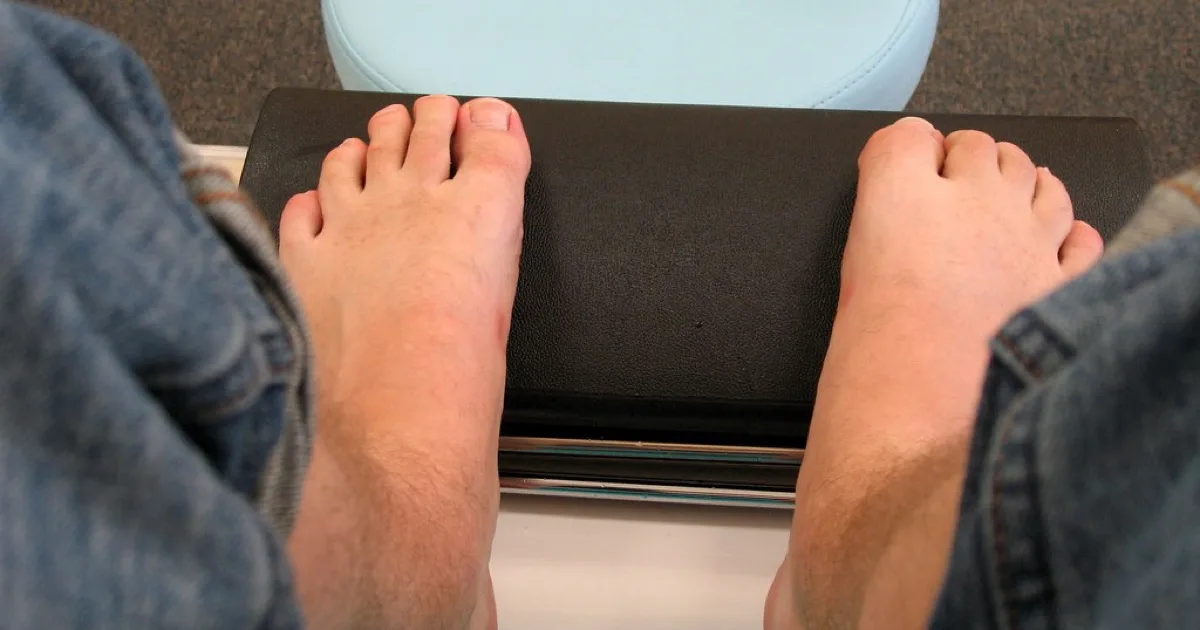Adult patient's bare feet during a foot-care visit