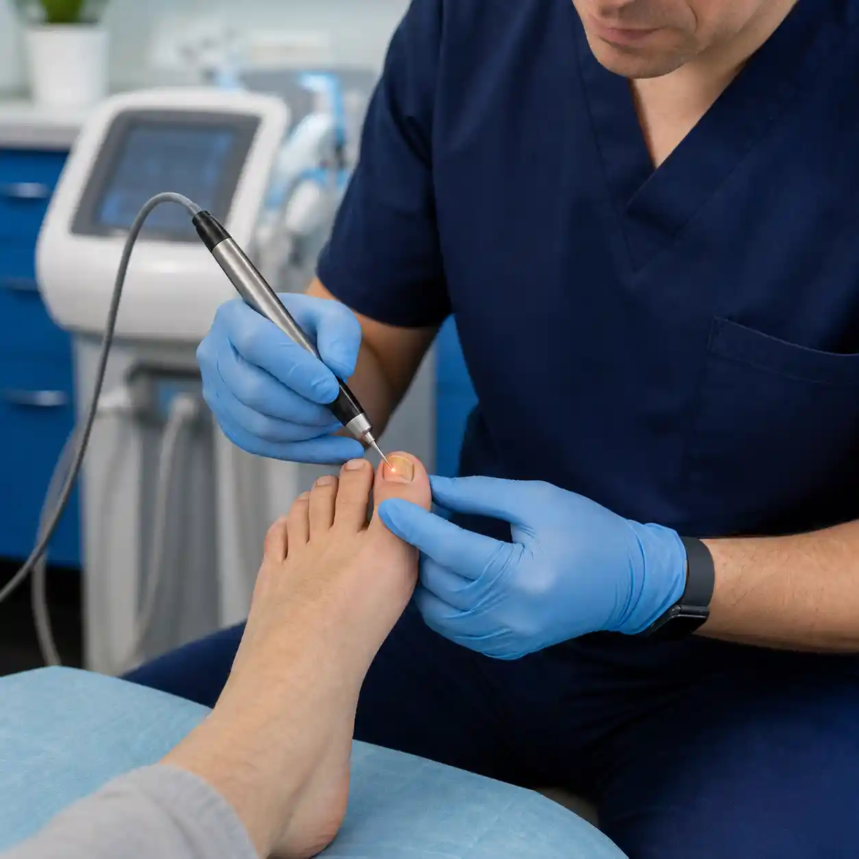 Laser Nail Treatment treatment for Fungal Nails